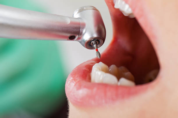 Best Emergency Root Canal Therapy in Waycross, GA